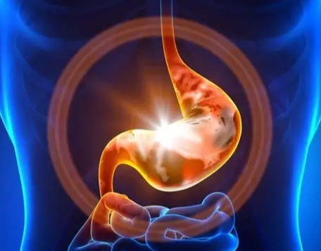 胃保健食品推薦