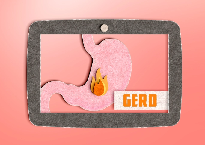 薏仁胃食道逆流：天然飲食療法全攻略