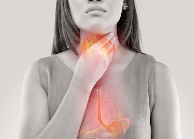 胃食道逆流食療