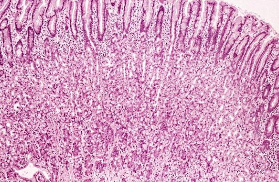 胃黏膜修復方法