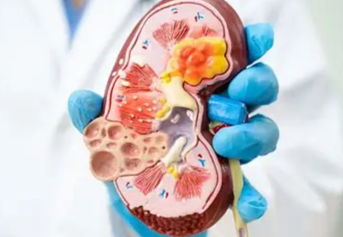 慢性腎臟病 飲食