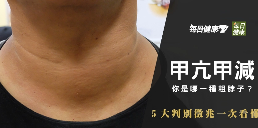 甲狀腺低下如何控制體重？從飲食、運動到藥物的完整攻略