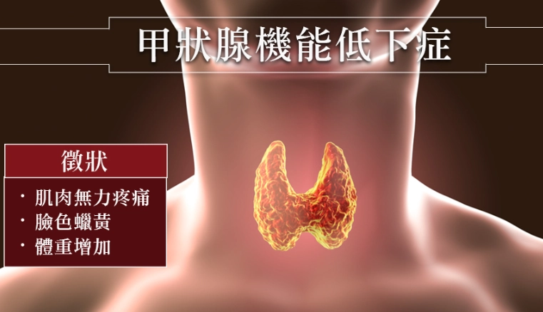 甲狀腺低下飲食