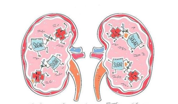 腎臟保健 腎臟保健