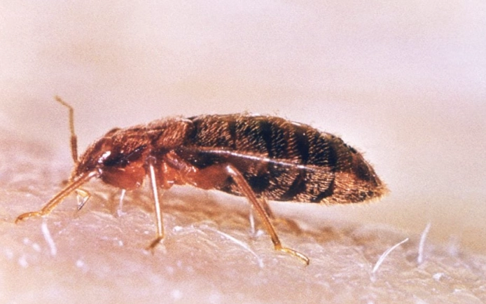 發現床蝨怎麼辦