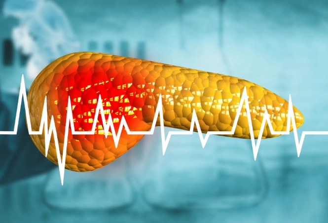 多囊性卵巢症狀