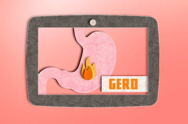 孕婦胃食道逆流喝什麼？10種安全舒緩飲品清單與專家建議