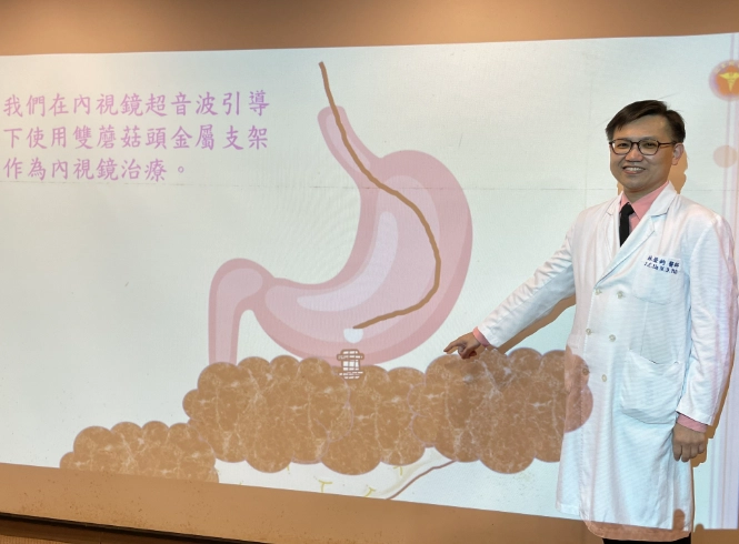 多囊性卵巢症候群