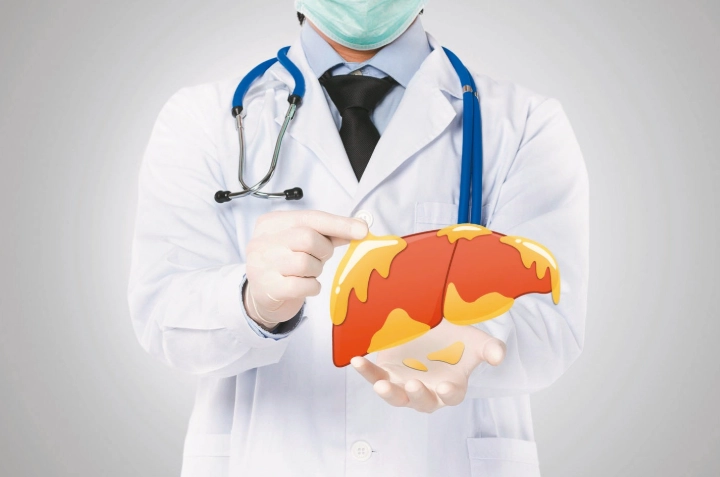 降脂肪肝保健食品全攻略：專家推薦與避坑指南