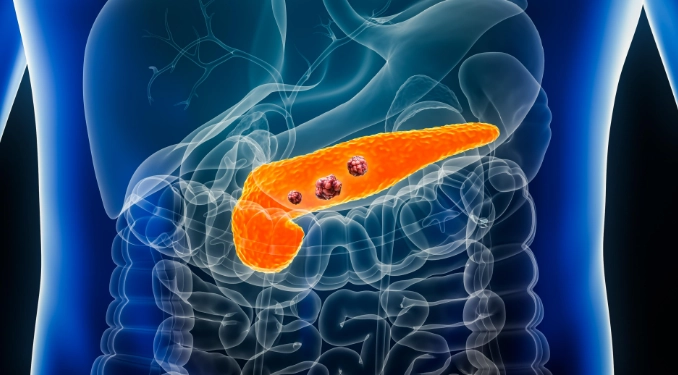 多囊性卵巢檢查流程