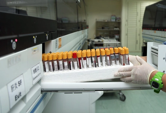 胰臟炎症狀抽血