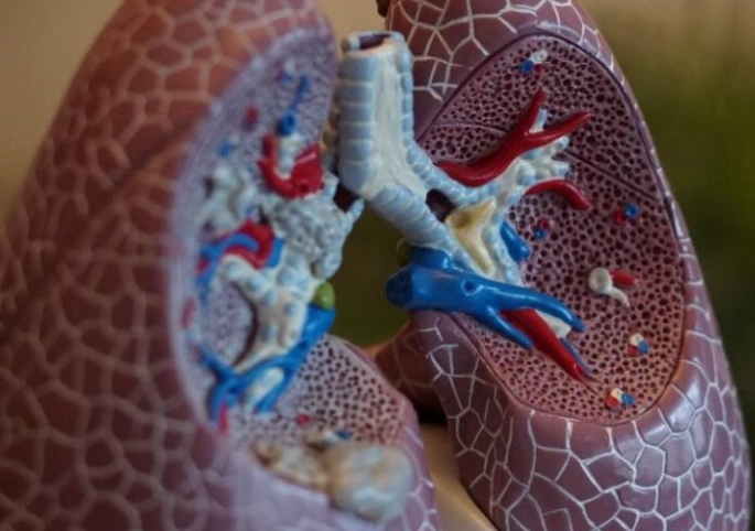 支氣管擴張如何管理？症狀緩解與日常照護完整指南