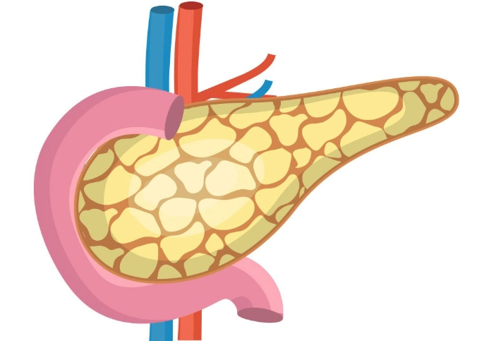 急性胰臟炎原因全解析：膽結石、酒精、高三酸甘油酯的深度探討