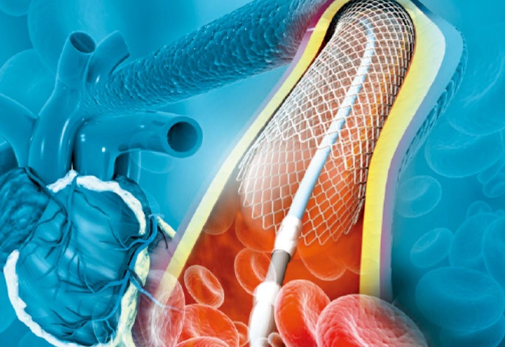 心臟血管鈣化飲食指南：從飲食原則到一週菜單，逆轉鈣化關鍵全解析
