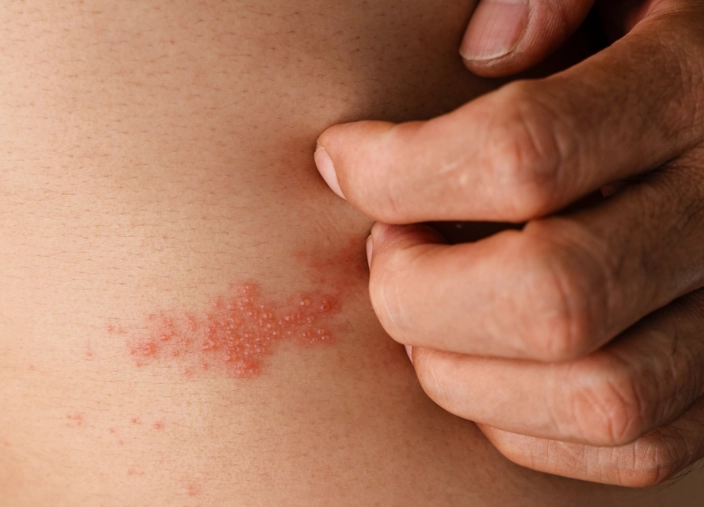 皮蛇可以吃海鮮嗎