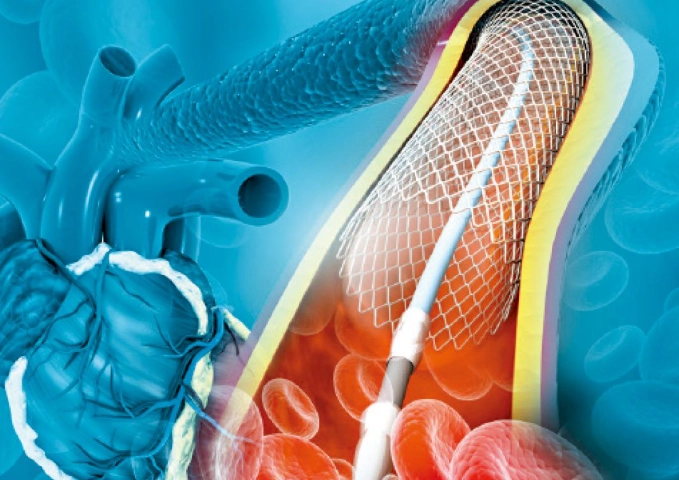 心血管鈣化用藥