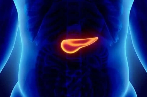 急性胰臟炎治療