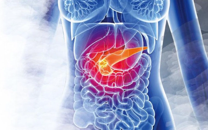 出血性胰臟炎症狀、治療與預防全指南：專家分享關鍵知識