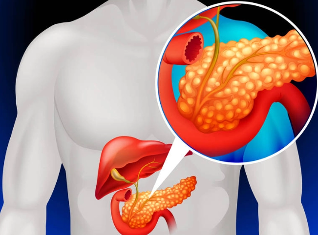 檢查胰臟發炎方法