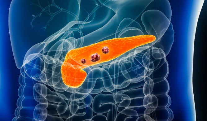 胰臟炎放屁：症狀解析、原因與實用應對心法