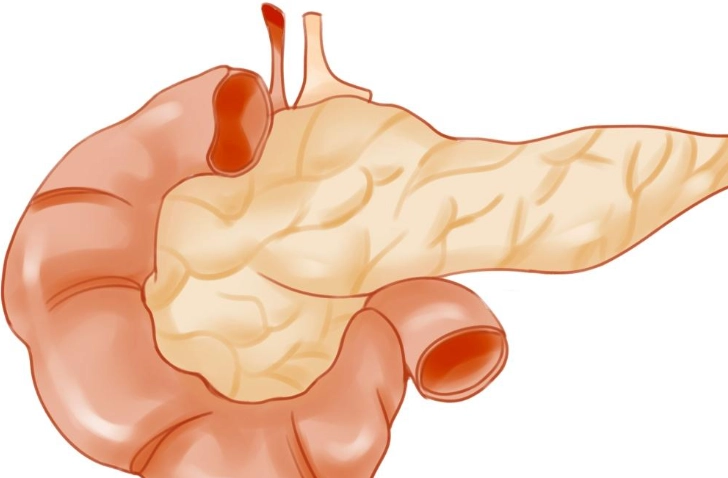 胰島素 治療 胰臟炎