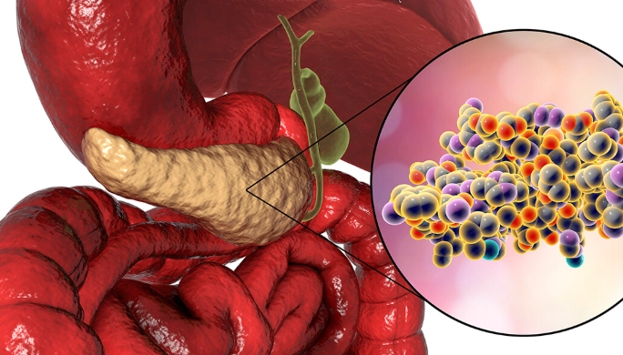 胰臟炎膽囊炎症狀自救指南：從劇痛到康復的緊急處理與飲食關鍵