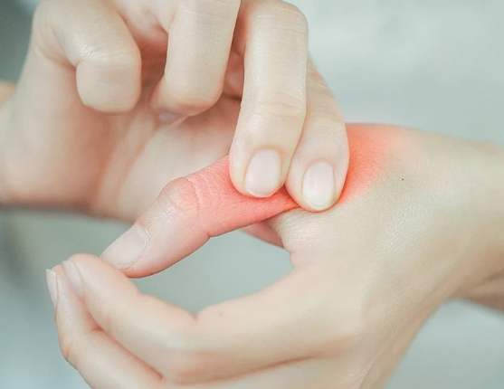 手指關節炎營養