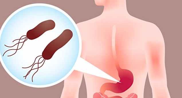 紅蘿蔔對胃潰瘍的影響