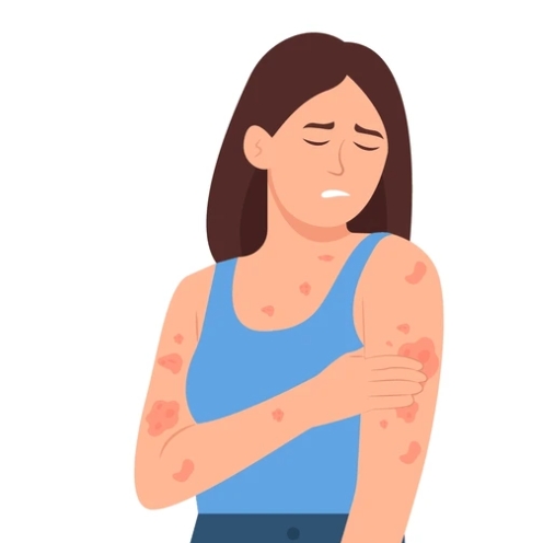 皮膚過敏飲食禁忌