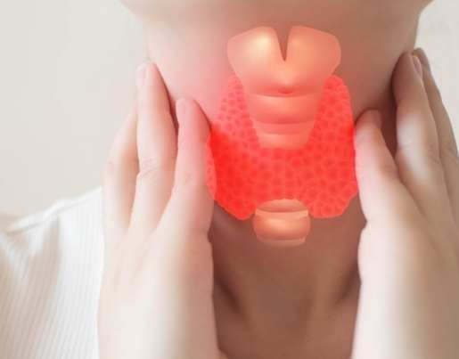 甲狀腺亢進不能吃的食物