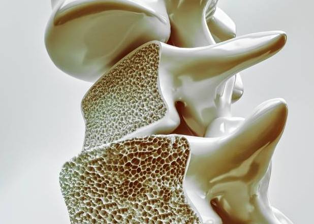 骨質疏鬆改善方法