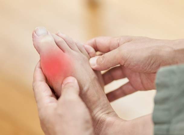 高尿酸血症症狀