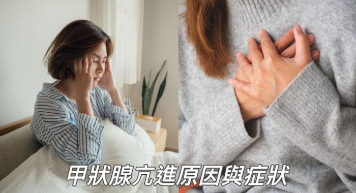 甲狀腺亢進 面包選擇