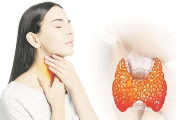 甲狀腺亢進 飲食