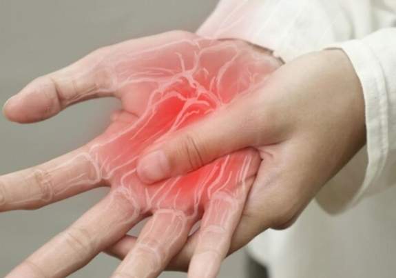 高尿酸血症症狀