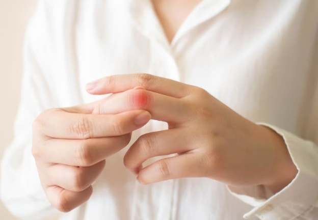 關節炎飲食建議