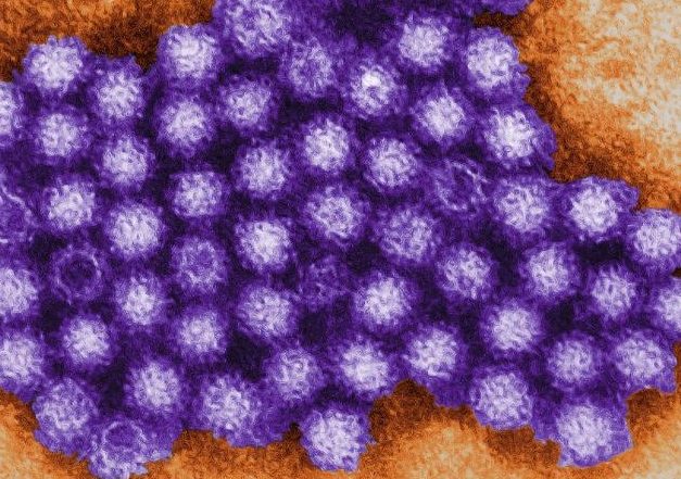 諾羅病毒飲食禁忌