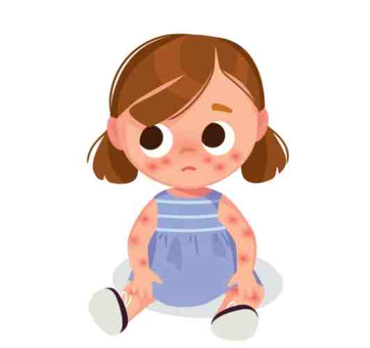 過敏不能吃的食物