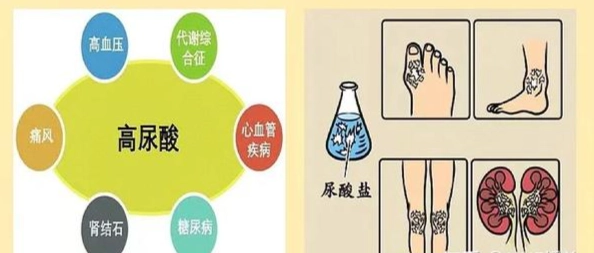 尿酸過高改善方法