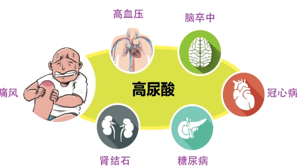 尿酸高飲食控制