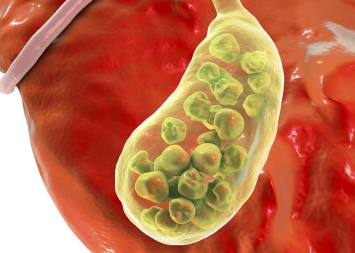 胰臟炎禁食時間