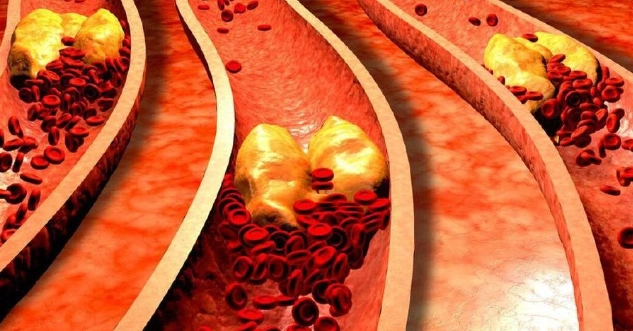 高血壓飲食禁忌