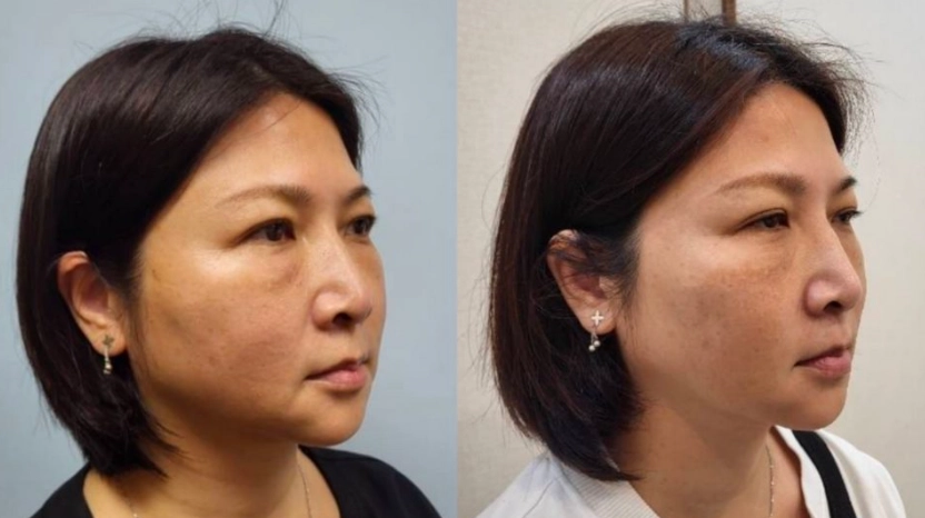 台灣小吃嘴邊肉