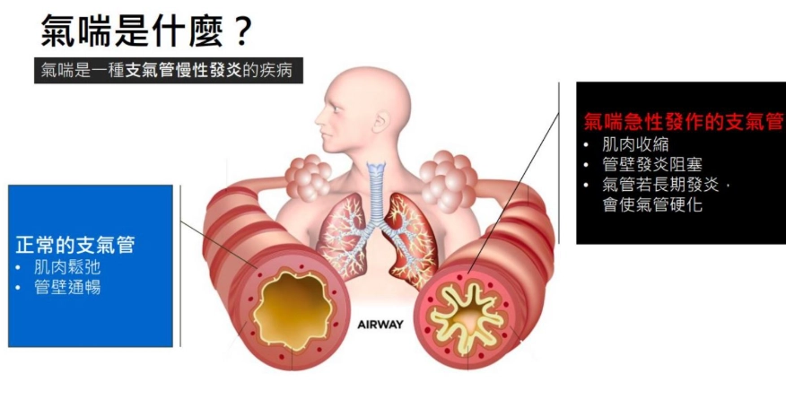 氣喘注意事項